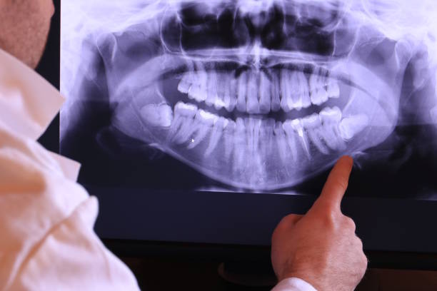 Best Emergency Dental Care for Trauma or Injury in Arthurtown, SC