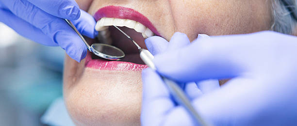 Best Emergency Root Canal Treatment in Arthurtown, SC